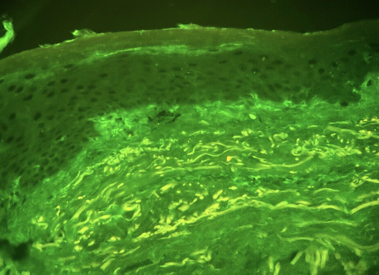 Microscopía de inmunofluorescencia de piel con fluorescencia verde
